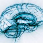 ‘Brain training’ program may help prevent dementia